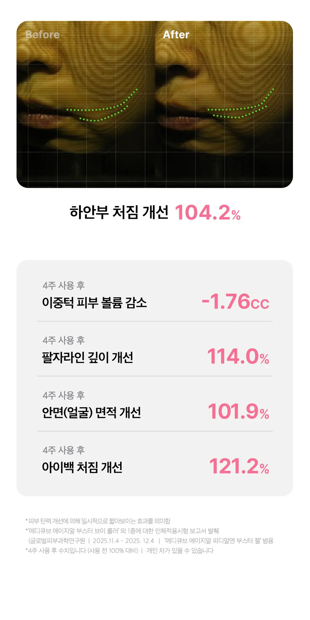 [이중턱/윤곽케어] 메디큐브 에이지알 부스터 브이롤러 헤드 (핑크/베이지) 상세페이지 34